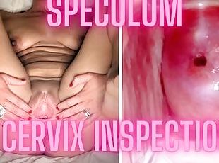 Ekstrem, Vagina (Pussy), Ibu, Rumah sakit, Test organ reproduksi wanita, Penyebaran