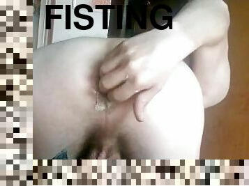 My anal fisting