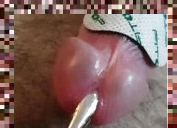 Electro tens - custom urethral probe
